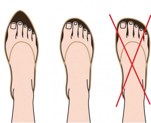 Quels sont les différents types de pieds ?