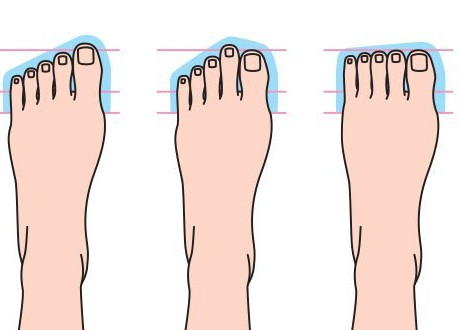 Les différentes formes de pieds